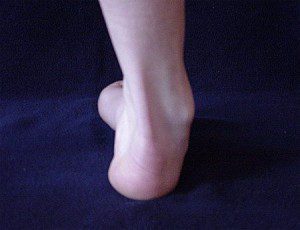 A láb betegségei