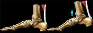 Podiart - láb felépítése - Achilles ín - lábbetegségek megelőzése, kezelése